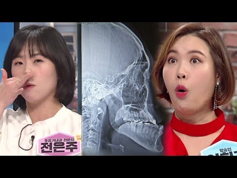 건강을 망치는 ‘입 호흡 자가 진단법’ 공개! (수요일N스타일) @좋은아침 5280회 20180321