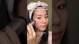 Snatched Jawline With Amiro R3 Turbo.