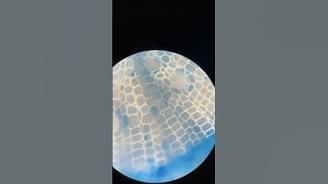 Root structures under microscope #microscopy #root_anatomy