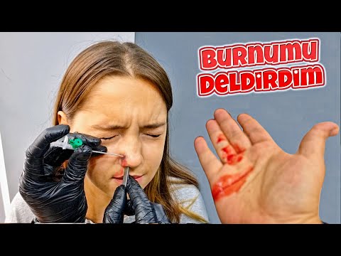 BURNUMU DELDİRDİM ÇOK KANADI VLOG