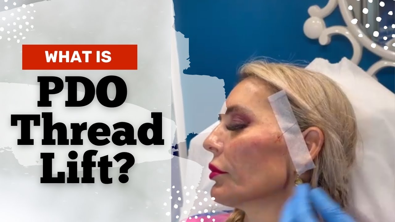 Pbg Thread What is PDO thread lift? Best PDO Thread Lift In West Palm Beach ...