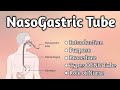 Nasogastric Tube   || Fundamental Of Nursing ||