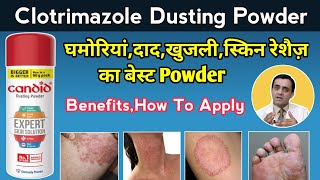 Clotrimazole dusting powder uses in hindi / Candid powder for fungal infection