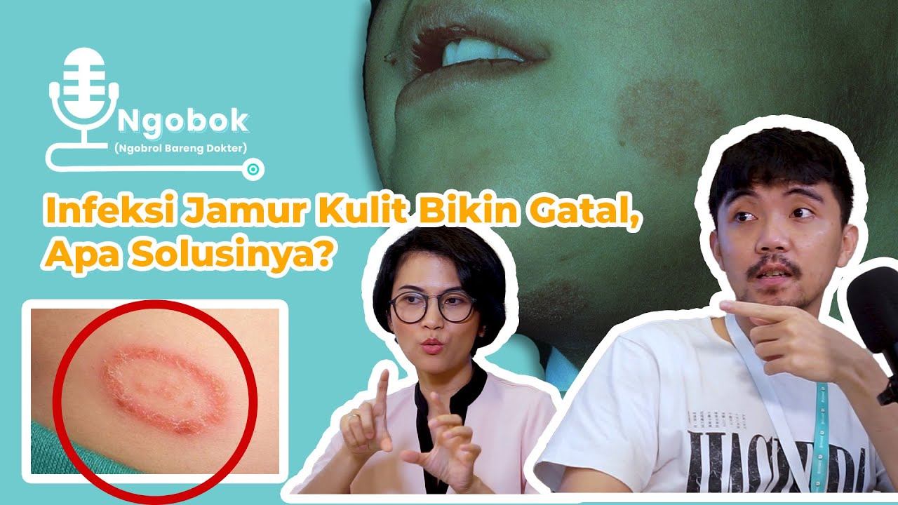 Ngobrol Bareng Dokter - Infeksi Jamur Kulit yang Menyebalkan