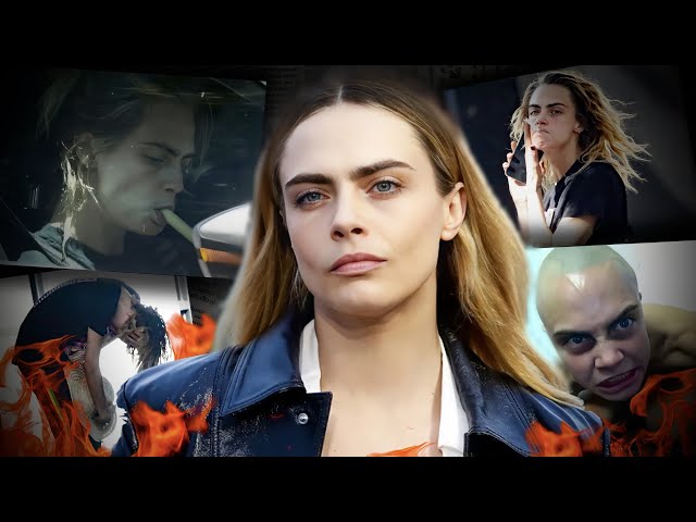 Cara Delevingne NEEDS HELP