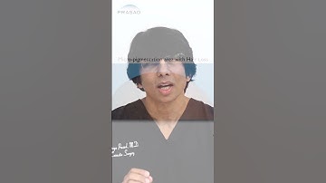 Scalp Micropigmentation Long-Term Results #scalpmicropigmentation