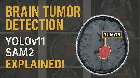 Brain Tumor Detection and Segmentation with YOLO11 and SAM2 | Code Explanations | Himel Sarder