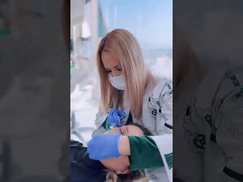 تزریق ژل لب روسی توسط خانم دکتر ساناز امیری