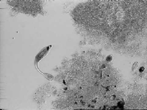 Video: Tetrahymena Corpi Basali
