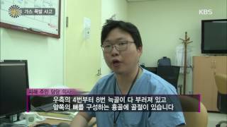 생활의 발견 - 가스 폭발 사고. 20160722