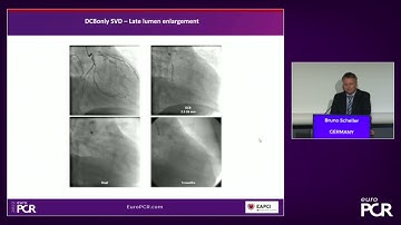 DCB and the possibility of a clean vessel - EuroPCR 2022