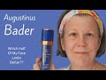 Using augustinus bader on half my face for 12 months  did it help