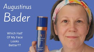 Using Augustinus Bader On Half My Face For 12 Months  Did It Help?