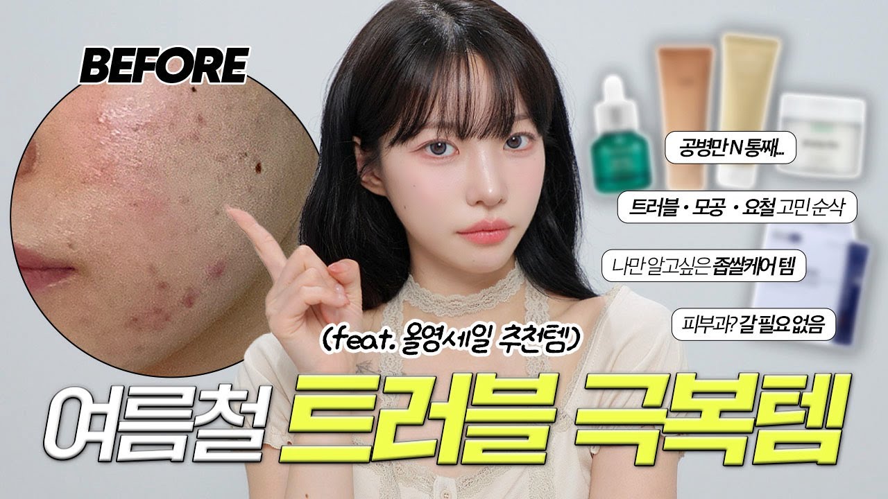 좁쌀,트러블 고민이신 분들 꼭 한번만 보세요;;🥺🔥3일만에 효과보는 트러블 극복템 추천💚 +각질,요철,모공 등등 ...