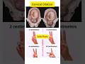 Cervical Dilation Measurement Cervix Dilation Cervix Length Dilation Chart Phase Measure Short Cervical Dilation Measurement Cervix Dilation Cervix Length Dilation Chart Phase Measure Short