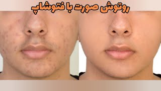 آموزش رایگان روتوش صورت با فتوشاپ|آموزش استامپ زدن در فتوشاپ