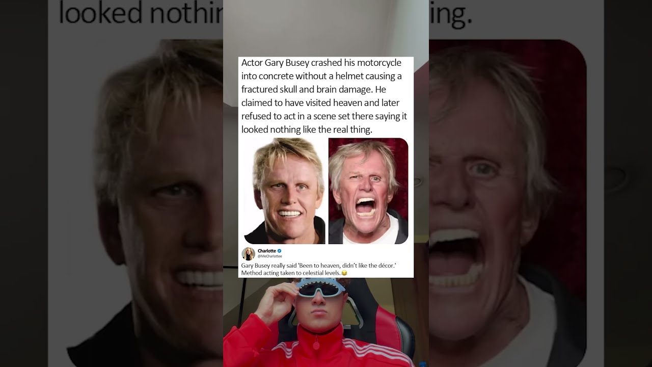Actor Gary Busey Crashed His Motorcycle Into Concrete Without A Helmet Causing Fractured Skull