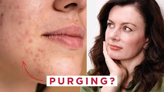 Acne Purging - What is it and How To Manage It Successfully | Dr Sam Bunting