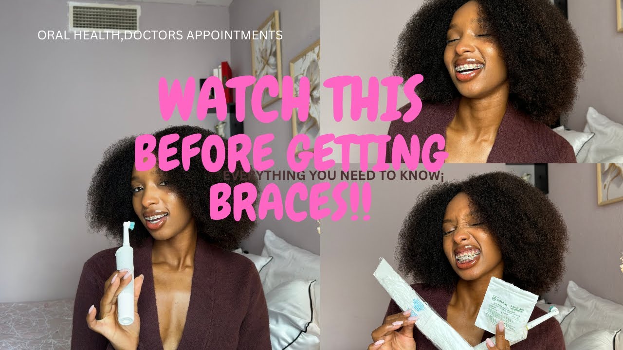Braces 101;What You Need To Know Before You Start!! - YouTube