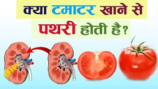 क्या टमाटर खाने से पथरी होती है ! Tamatar se Kya Pathri Hoti Hai, Kidney Stone