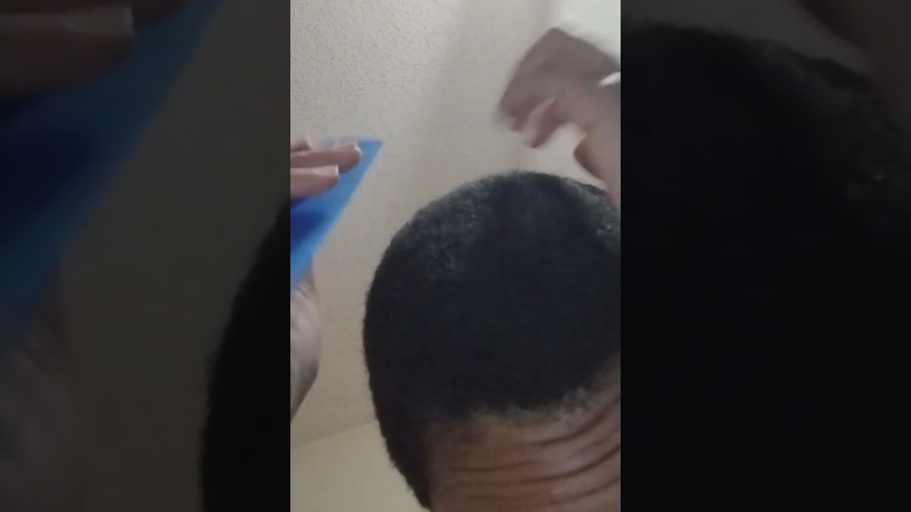 Another Day, Another Dandruff