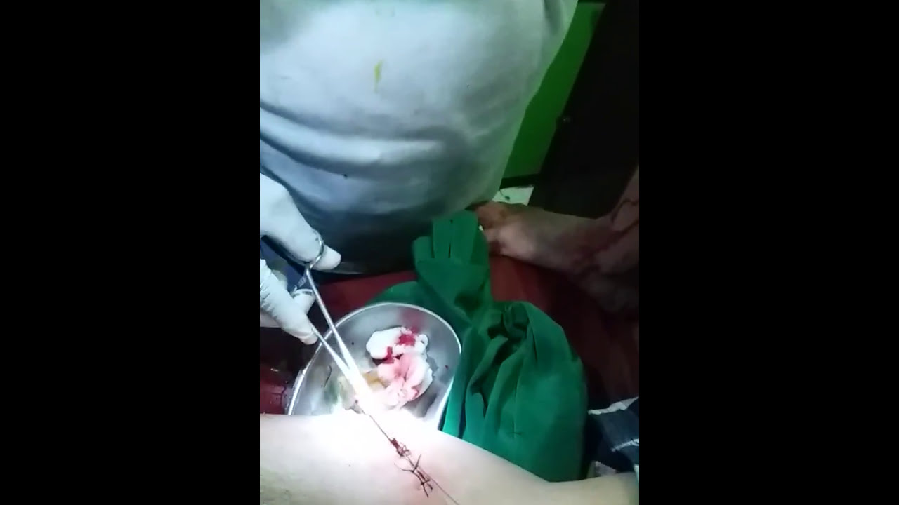 Kaki David Kena Kaca Youtube
