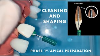 Preclinical laboratory demonstration - cleaning and shaping - apical preparation