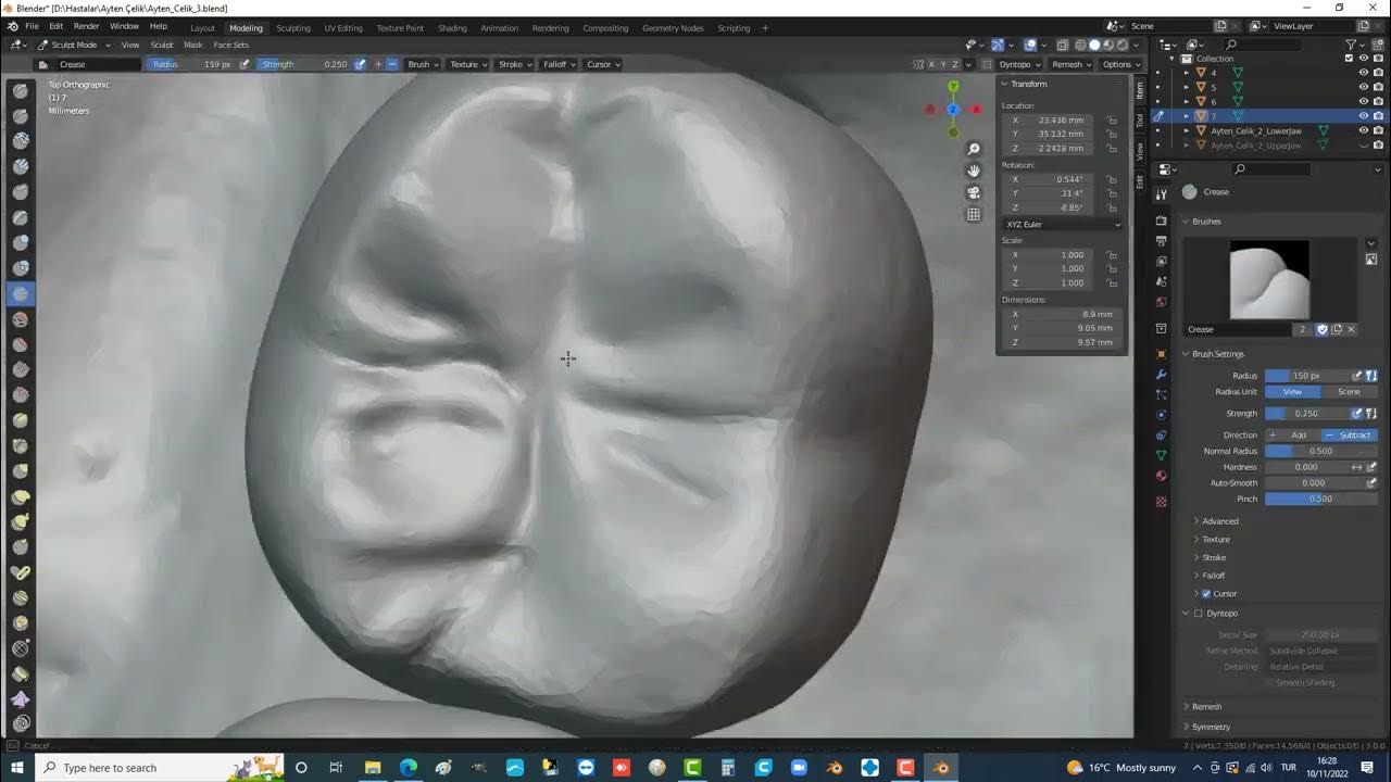 Designing A Removable Partial Denture Using Blender Software YouTube