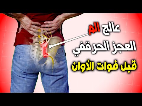 فيديو: أين هو العصب قبل العجزي؟