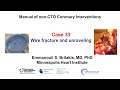 Case 33: Manual of non-CTO coronary interventions: guidewire fracture and unraveling