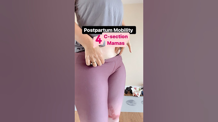 C-Section MAMAs this one is for you ❤️ #postpartum #csectionrecovery #mobility #shorts