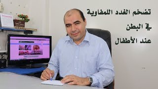 التهاب وتضخم الغدد اللمفاوية في البطن عند الاطفال