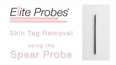 Spear Probe | Skin Tag Removal | Elite Probes®