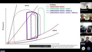 LV Distension on VA ECMO