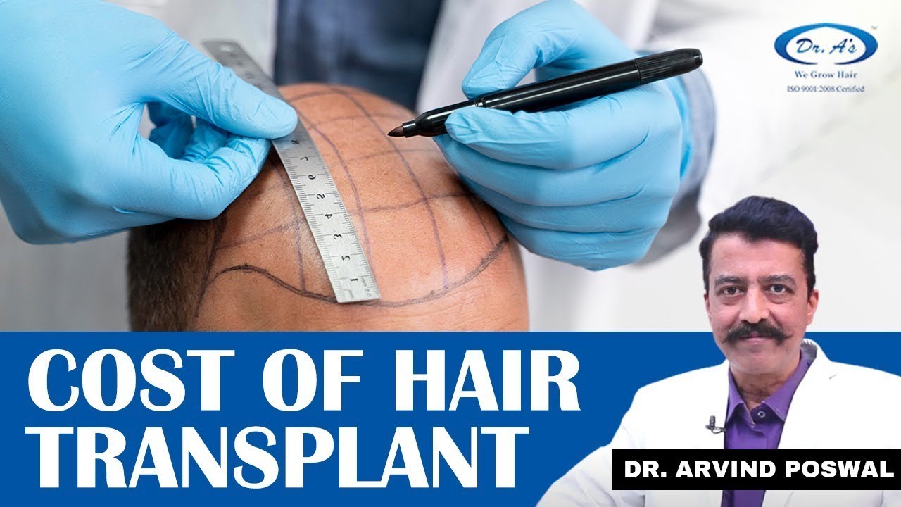 👉What is The Cost of Hair Transplant? How long do Transplanted Hair last? Hair Transplant In