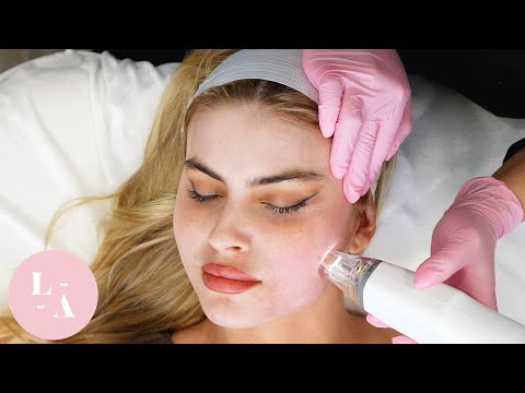 Microneedle the Imperfections Away