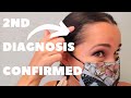 Telogen Effluvium 2-Month Follow Up | Female Pattern Alopecia Diagnosis | 20-06-03