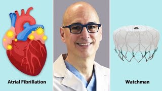 Surgeon Q&A: The Watchman, Atrial Fibrillation & Heart Valve Disease with Dr. Marc Gerdisch
