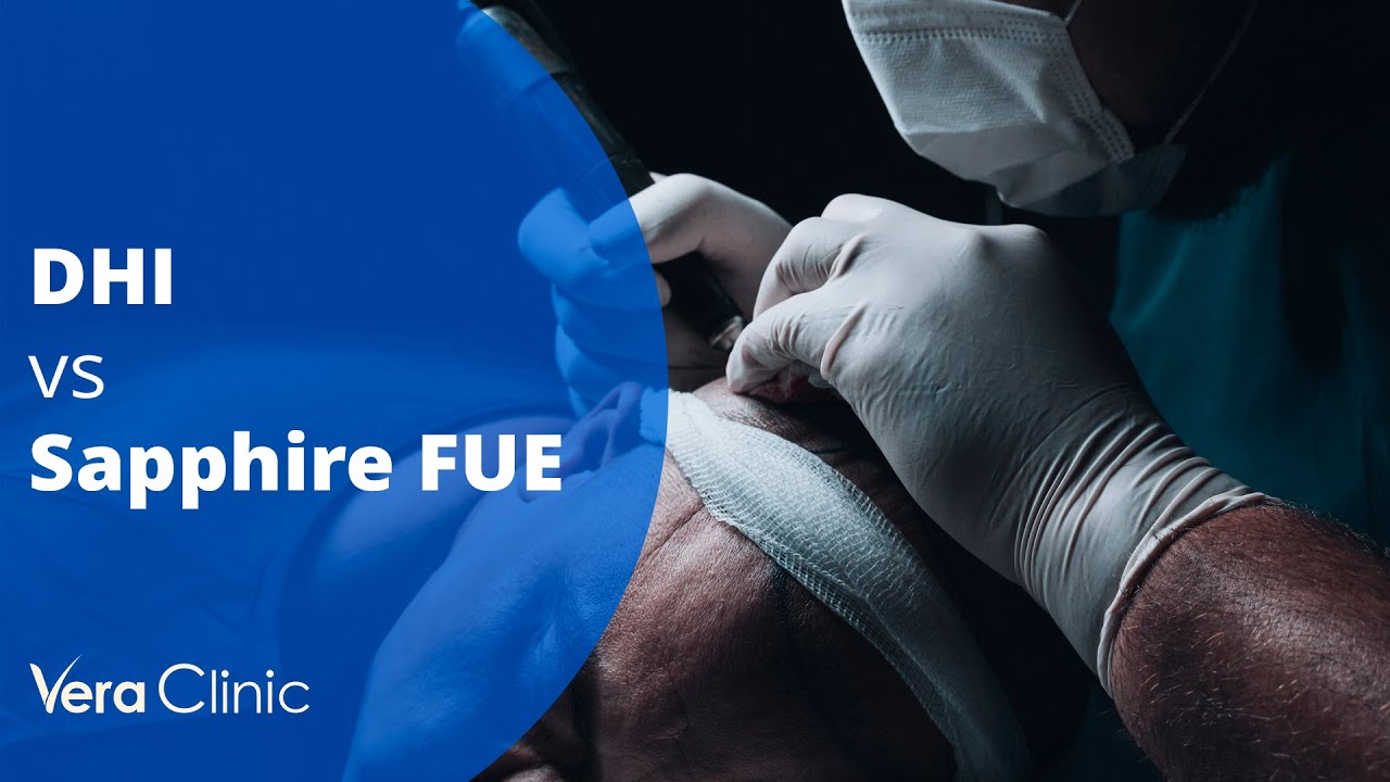 Is Fue Better Than Dhi Is Fue Better Than Dhi