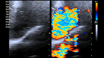 PDA on echocardiography in a French Bulldog