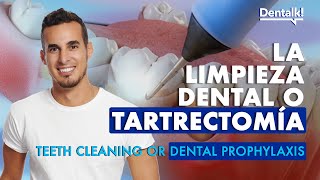Are you going to get a DENTAL CLEANING? This is what you need to know about TARTRECTOMY | Dentalk! ©