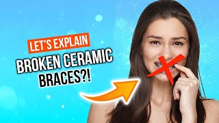 How To Fix BROKEN BRACES?! | Ceramic Braces Hooks