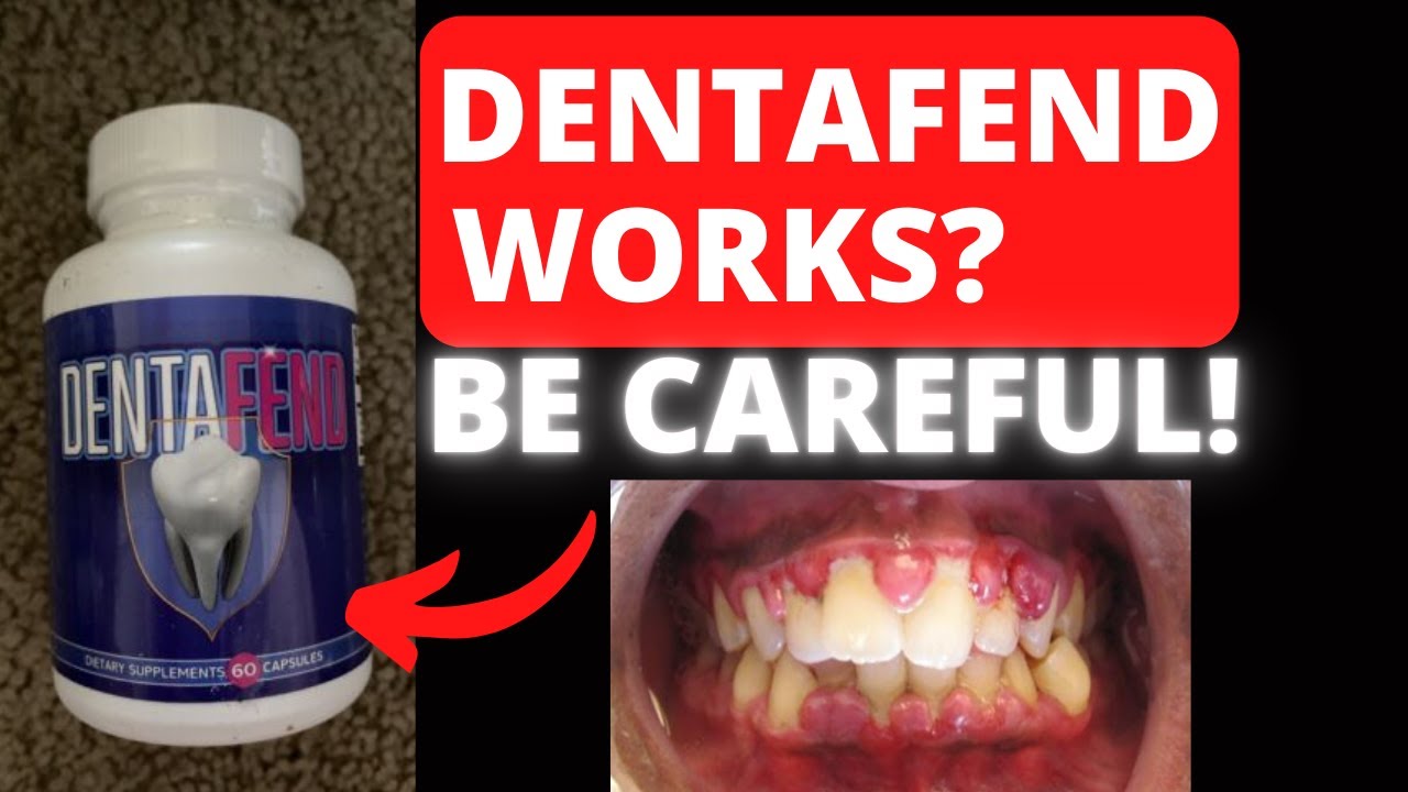 ⚠️ DentaFend Review – Does DentaFend Really Work? THIS DENTAFEND REVIEW MIGHT JUST SAVE YOUR LIFE!