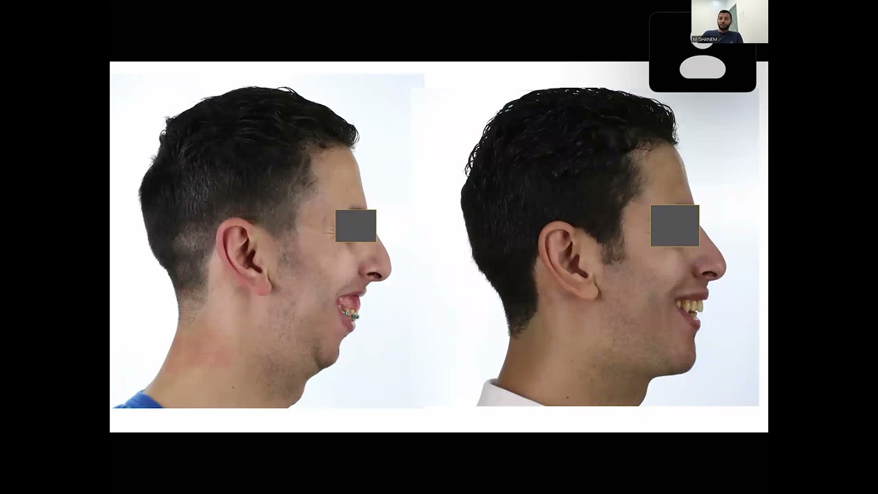 Accepted Abstracts - IAOMS