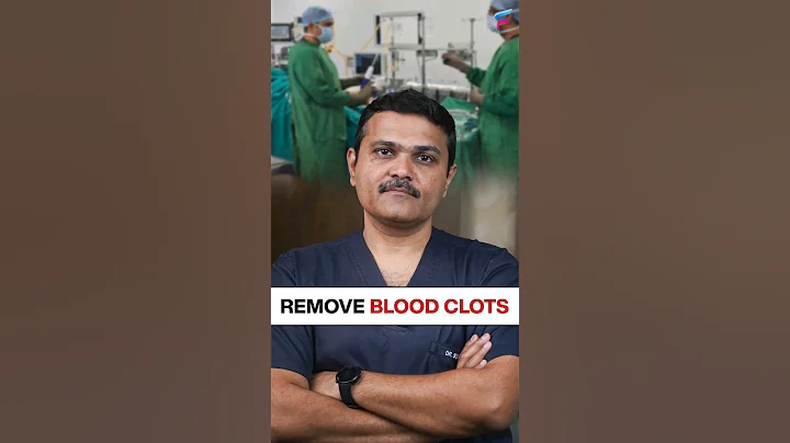 Remove BLOOD CLOTS without Surgery! #vascularsurgery #shortsvideo #thrombosis