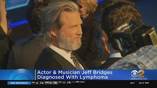 Jeff Bridges Starting Treatment After Being Diagnosed With Lymphoma