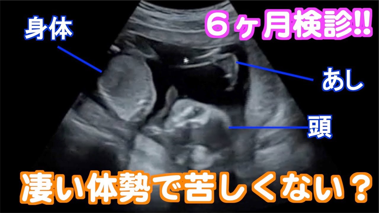 エコー映像 ６ヶ月の妊婦検診に行ってきました Youtube