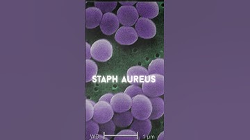 The Ancient Substance that Killed bacteria in 2 Hours! #Antibiotics #NaturalRemedies #Science