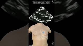 Deepscope Ultrasound Simulator screenshot 1