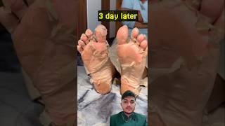 foot peel mask #footpeel #pedicure #crackheels #footmask